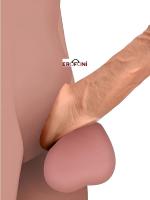 Erofoni Ucu 7 Cm Dolgulu Süper Realistik 21 CM Uzatmalı Penis Kılıfı 